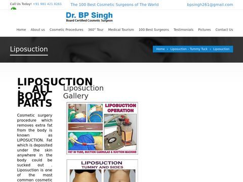Liposuction Surgery Punjab