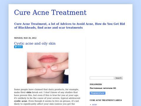 Treatments For Acne