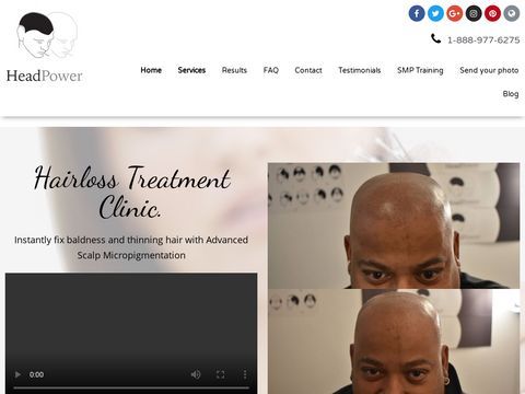 Scalp Micropigmentation