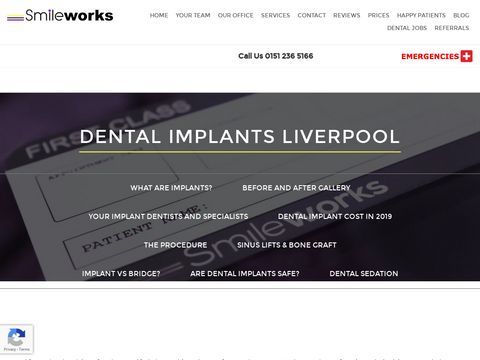 Dental Implants Liverpool