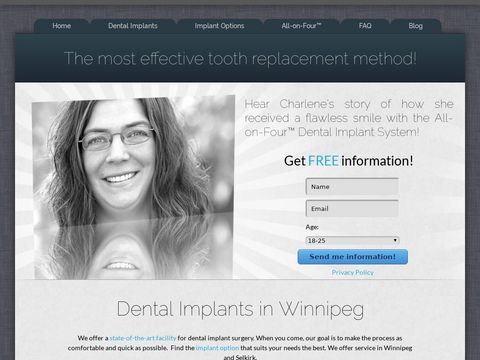 Dental Implants Winnipeg | Permanent Dentures