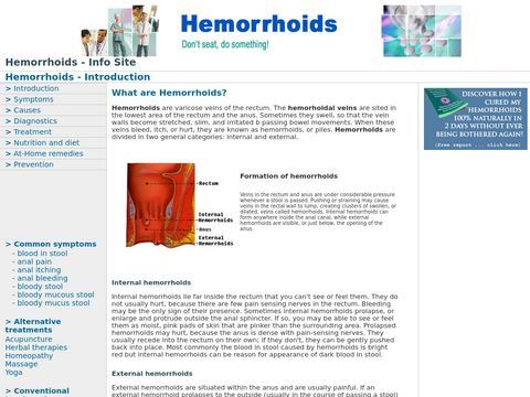 Hemorroid Information