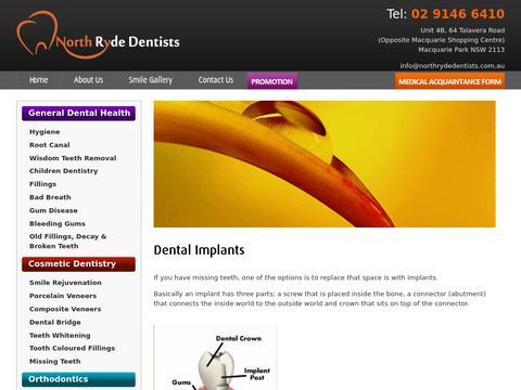 Dental Implants Sydney