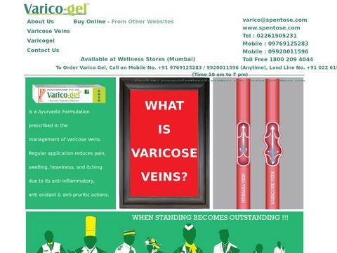 Varicose Vein Treatment Symptoms